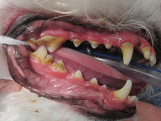 Before Dental Prophylaxis